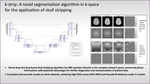 k-strip: A novel segmentation algorithm in k-space for the application of skull stripping